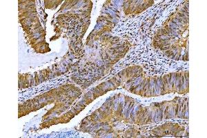 IHC analysis of NF1 using anti-NF1 antibody (ABIN7600195).