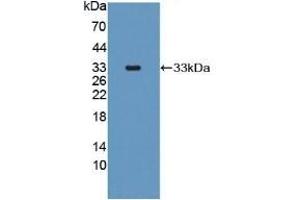 Detection of Recombinant MRP1, Human using Polyclonal Antibody to Multidrug Resistance Associated Protein 1 (MRP1) (ABCC1 anticorps)