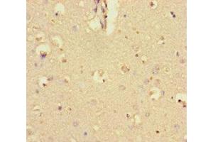 Immunohistochemistry of paraffin-embedded human brain tissue using ABIN7145840 at dilution of 1:100 (KCTD16 anticorps  (AA 201-428))