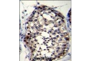 anti-Rhophilin Associated Tail Protein 1-Like (ROPN1L) (AA 32-60), (N-Term) antibody