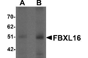 Western Blotting (WB) image for anti-F-Box and Leucine-Rich Repeat Protein 16 (FBXL16) (C-Term) antibody (ABIN1030390)