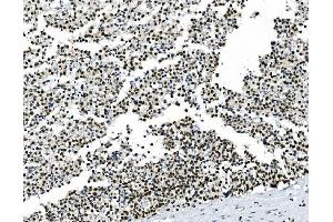 IHC analysis of HOXD11 using anti-HOXD11 antibody (ABIN7603174).