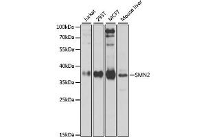 Western blot analysis of extracts of various cell lines, using SMN2 antibody (ABIN6127948, ABIN6148135, ABIN6148138 and ABIN6216175) at 1:1000 dilution. (SMN2 anticorps  (AA 1-197))