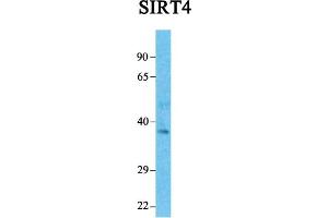 Host:  Rabbit  Target Name:  SIRT4  Sample Tissue:  Human Fetal Liver  Antibody Dilution:  1. (SIRT4 anticorps  (Middle Region))