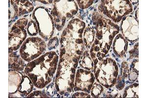 Image no. 3 for anti-ClpP Caseinolytic Peptidase, ATP-Dependent, Proteolytic Subunit Homolog (E. Coli) (CLPP) antibody (ABIN1497535)