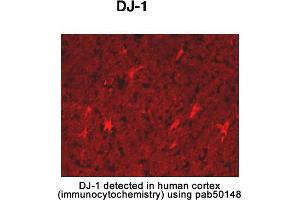 Image no. 2 for anti-Parkinson Protein 7 (PARK7) (AA 150-189), (C-Term) antibody (ABIN363457) (PARK7/DJ1 anticorps  (C-Term))