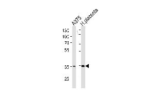 AKR1B1 Antibody (C-term) (ABIN389205 and ABIN2839363) western blot analysis in  cell line and human placenta tissue lysates (35 μg/lane). (AKR1B1 anticorps  (C-Term))