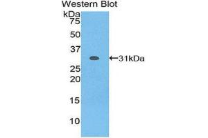 Western Blotting (WB) image for anti-Nicastrin (NCSTN) (AA 420-655) antibody (ABIN1859974) (Nicastrin anticorps  (AA 420-655))