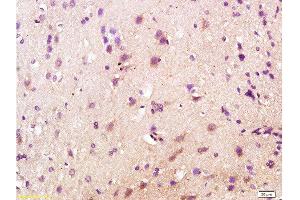 Formalin-fixed and paraffin embedded rat brain labeled with Anti-CD200R/Orexin receptor Polyclonal Antibody, Unconjugated  at 1:200 followed by conjugation to the secondary antibody and DAB staining. (OX1R/OX2R anticorps  (AA 321-425))