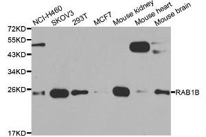 Western blot analysis of extracts of various cell lines, using RAB1B antibody. (RAB1B anticorps)
