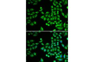 Immunofluorescence (IF) image for anti-Protein tyrosine Phosphatase, Non-Receptor Type 1 (PTPN1) antibody (ABIN1980139) (PTPN1 anticorps)