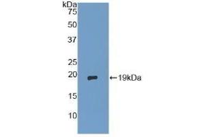 Detection of Recombinant dSIP, Human using Polyclonal Antibody to Delta-Sleep Inducing Peptide (dSIP) (dSIP (AA 1-134) anticorps)