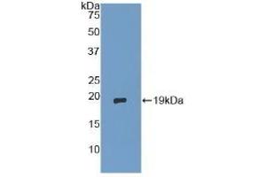 Detection of Recombinant dSIP, Human using Polyclonal Antibody to Delta-Sleep Inducing Peptide (dSIP) (TSC22D3 anticorps  (AA 1-134))