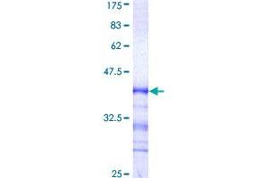 Image no. 1 for Cyclin-Dependent Kinase 13 (CDK13) (AA 1-90) protein (GST tag) (ABIN1348809)