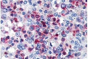 Human Spleen (formalin-fixed, paraffin-embedded) stained with CD63 antibody ABIN239811 at 10 ug/ml followed by biotinylated anti-mouse IgG secondary antibody ABIN481714, alkaline phosphatase-streptavidin and chromogen. (CD63 anticorps)