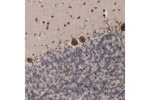 Immunohistochemical staining of human cerebellum with SOWAHB polyclonal antibody  shows strong cytoplasmic and nuclear positivity in Purkinje cells and molecular layer. (SOWAHB anticorps)