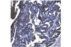 IHC analysis of GSDMD using anti-GSDMD antibody (ABIN7599433). (GSDMD anticorps  (AA 1-484))