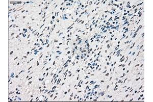 Immunohistochemical staining of paraffin-embedded Ovary tissue using anti-RAD9Amouse monoclonal antibody. (RAD9A anticorps)