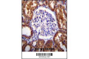 SLC12A6 Antibody immunohistochemistry analysis in formalin fixed and paraffin embedded human kidney tissue followed by peroxidase conjugation of the secondary antibody and DAB staining.