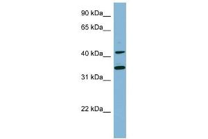 BLNK antibody used at 1 ug/ml to detect target protein. (B-Cell Linker anticorps  (Middle Region))