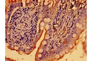 Immunohistochemistry of paraffin-embedded human small intestine tissue using ABIN7169226 at dilution of 1:100 (WNK2 anticorps  (AA 1177-1464))