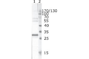 Western Blot testing of HIV-1 recombinant Nef protein. (HIV-1 Nef (AA 195-205) anticorps)