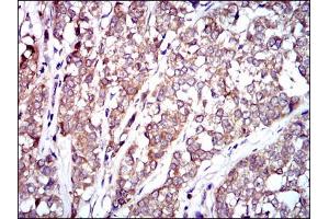 Image no. 1 for anti-V-Raf-1 Murine Leukemia Viral Oncogene Homolog 1 (RAF1) antibody (ABIN1500582) (RAF1 anticorps)