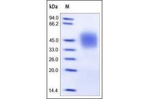 Human FCGR3A / CD16a (F158), His Tag on SDS-PAGE under reducing (R) condition. (FCGR3A Protein (AA 17-208) (His tag))