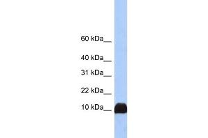 WB Suggested Anti-PFN1 Antibody Titration:  0. (PFN1 anticorps  (N-Term))