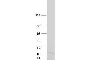Validation with Western Blot