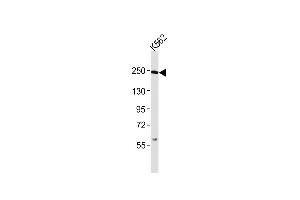 Anti-Smarca4 Antibody (C-term)at 1:2000 dilution + K562 whole cell lysates Lysates/proteins at 20 μg per lane.