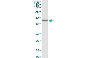 CTH monoclonal antibody (M01), clone 4E1-1B7.