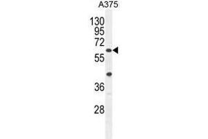 ACF Antibody (C-term) western blot analysis in A375 cell line lysates (35ug/lane).