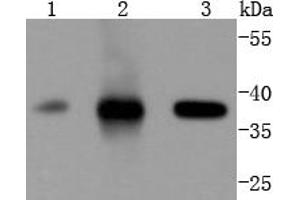 Lane 1: Jurkat, Lane 2: K562, Lane 3: Hela lysates probed with Cdk6 (4F7) Monoclonal Antibody  at 1:1000 overnight at 4˚C. (CDK6 anticorps)