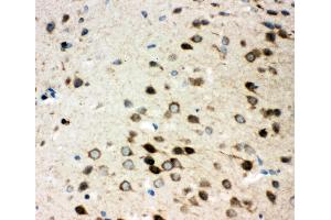 Anti-Integrin alpha 3 antibody, IHC(P) IHC(P): Rat Brain Tissue