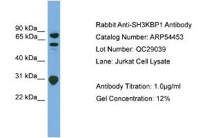 WB Suggested Anti-SH3KBP1  Antibody Titration: 0. (SH3KBP1 anticorps  (N-Term))