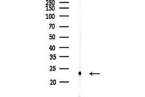 Western blot analysis of lysates from PC12 cells, using Caveolin 1 Antibody at 1/1000 dilution.