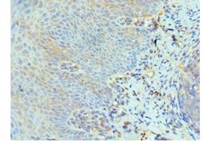 Immunohistochemistry of paraffin-embedded human tonsil tissue using ABIN7151466 at dilution of 1:100 (GCN2 anticorps  (AA 1-300))