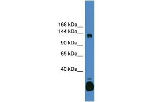 WB Suggested Anti-C10orf12 Antibody Titration: 0. (Lcor anticorps  (C-Term))