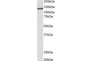 ABIN2564306 (0. (Oncostatin M Receptor anticorps  (Internal Region))