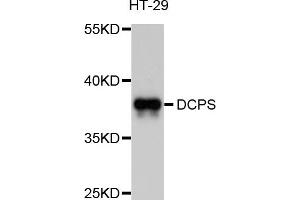 Western blot analysis of extracts of HT-29 cells, using DCPS antibody (ABIN5997562) at 1/1000 dilution. (DCPS anticorps)