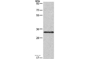 Western blot analysis of Jurkat cell, using IL1A Polyclonal Antibody at dilution of 1:666 (IL1A anticorps)