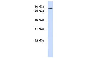 TMEM16K antibody used at 1 ug/ml to detect target protein. (Anoctamin 10 anticorps  (C-Term))