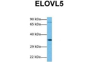 Host:  Rabbit  Target Name:  ELOVL5  Sample Tissue:  Human Jurkat  Antibody Dilution:  1. (ELOVL5 anticorps  (N-Term))