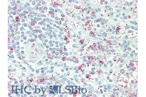 Detection of PTPRB in Human Spleen Tissue using Polyclonal Antibody to Protein Tyrosine Phosphatase Receptor Type B (PTPRB)