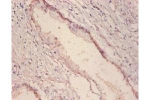 Immunohistochemistry of paraffin embedded human prostate tissue using ABIN7143879 at dilution of 1:100