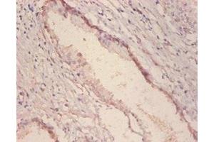 Immunohistochemistry of paraffin embedded human prostate tissue using ABIN7143879 at dilution of 1:100 (GLA anticorps  (AA 32-429))