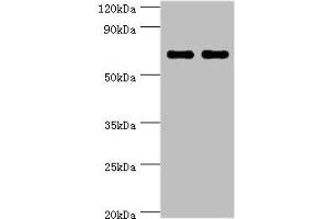 Western blot All lanes: BIRC2 antibody at 5 μg/mL Lane 1: HepG2 whole cell lysate Lane 2: K562 whole cell lysate Secondary Goat polyclonal to rabbit IgG at 1/10000 dilution Predicted band size: 70, 65 kDa Observed band size: 70 kDa (BIRC2 anticorps  (AA 1-300))