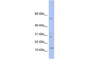 WB Suggested Anti-TD1 Antibody Titration: 0. (TLX1 Neighbor anticorps  (Middle Region))