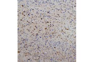 IHC analysis of RET using anti-RET antibody (ABIN6719502). (Ret Proto-Oncogene anticorps  (AA 29-304))